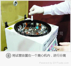 PRP祛皱 离心机 - HENKO - 中美之光 (中国 北