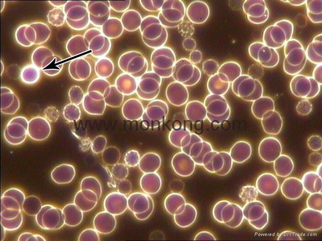 Dark Ground Microscopy