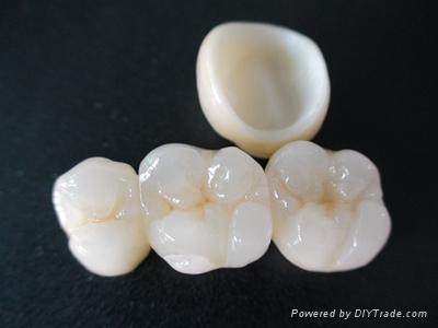 Full_ceramic_crown.jpg