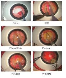 白内障手术仿真练习器 - 机太郎 (中国 北京市 贸