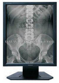 医用显示器 - MYM-2010 - MOYOSUN魔言 (中国