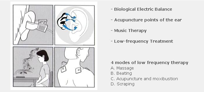 acupuncture pain relief acupuncture pain relief
