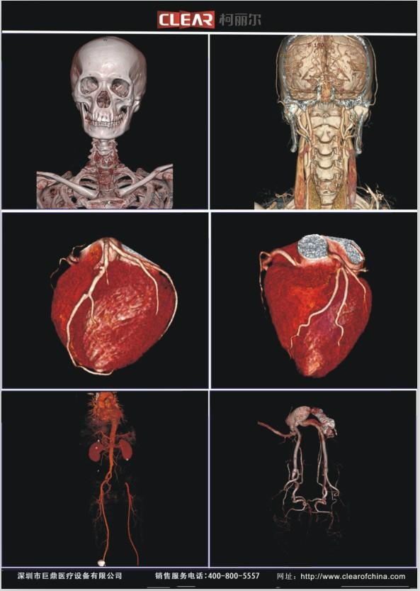 医用彩超胶片(柯丽尔) (中国 广东省 生产商) - 其