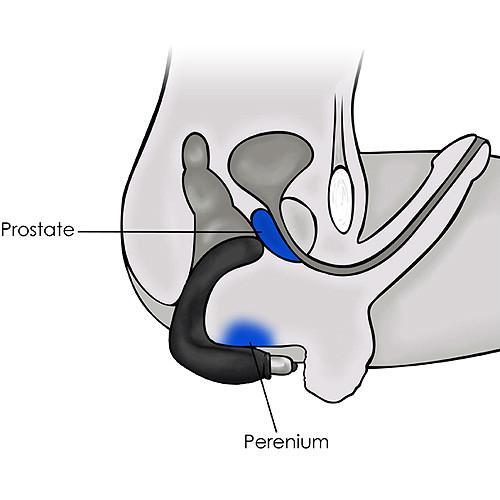 前列腺按摩器+-+hjj0019-2