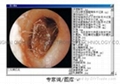 内窥镜数码影像工作站
