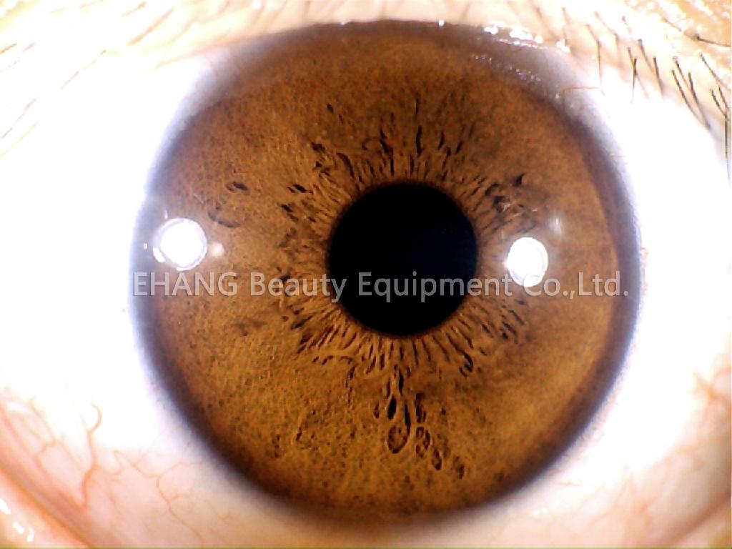 虹膜仪\/虹膜检测仪