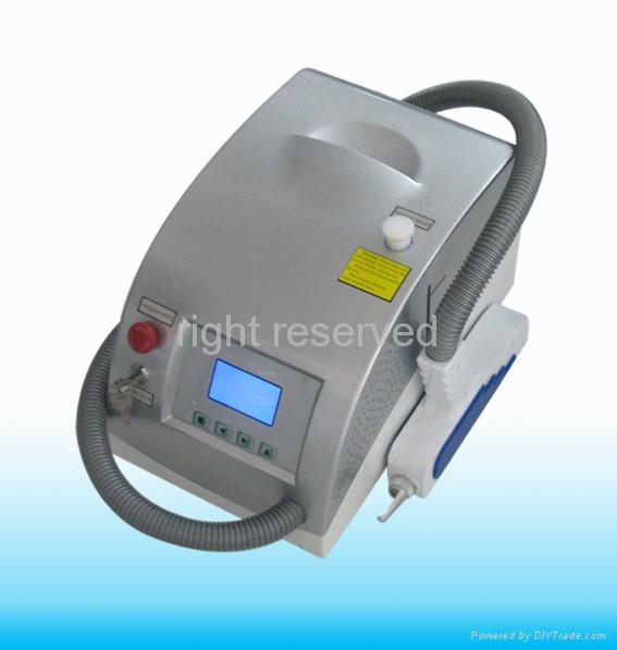 laser tattoo removal equipment