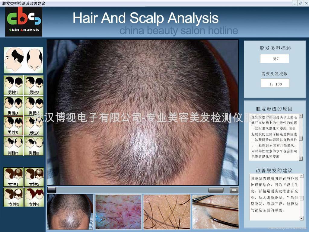 Hair and Scalp analysis system CBS1718 CBSHOTLINE (China