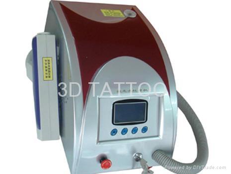 Laser tattoo removal