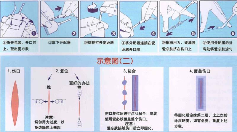 epiglu人体组织粘合剂