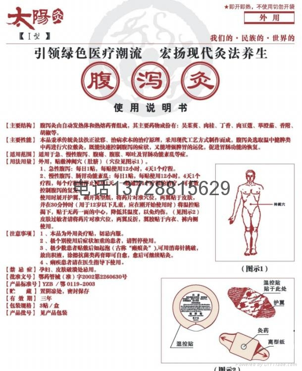 广东太阳神太阳灸腹泻灸