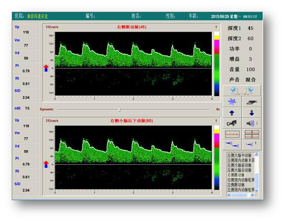 便携式超声经颅多普勒 江苏省 生产商 产品目录