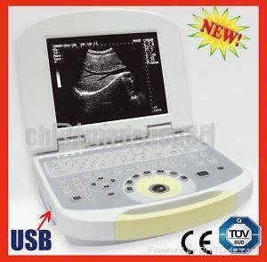 Laptop Ultrasound Scanner Ultrasound Machine US System