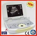 Laptop Ultrasound Scanner Ultrasound Machine US System 1