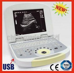 Laptop Ultrasound Scanner Ultrasound Machine US System