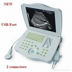 Full Digital Laptop Ultrasound Scanner Machine
