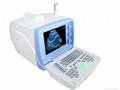 Full Digital Portable Ultrasound Scanner Ultrasound Machine