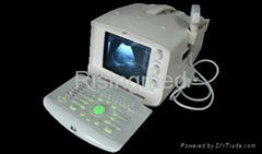 Digital Portable Ultrasound Scanner Ultrasound machine system