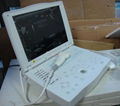 Laptop Ultrasound Scanner