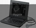 Digital Notebook Ultrasound Scanner