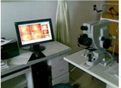 Digital conversion for slit lamp