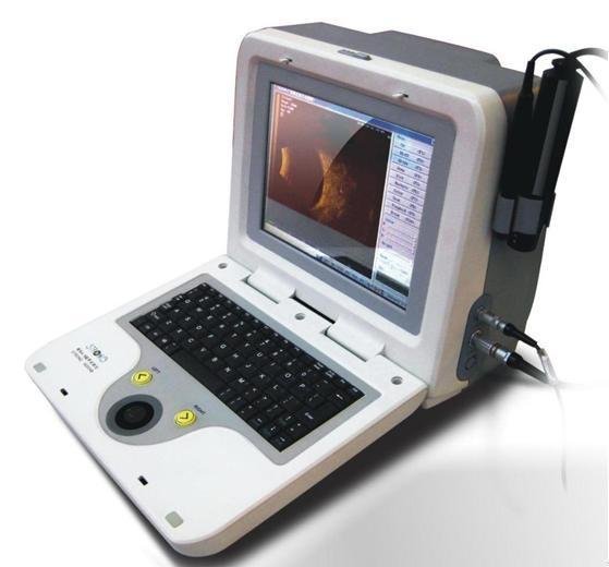 Digital conversion for AB scan