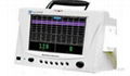 PM-9000B Fetal Monitor 1