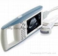 Digital Palmtop Ultrasound Scanner 1