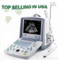 Digital Ultrasound Scanner