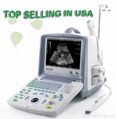 Digital Ultrasound Scanner 