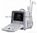 Full Digital Ultrasound Scanner