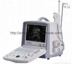 Full Digital Ultrasound Scanner 