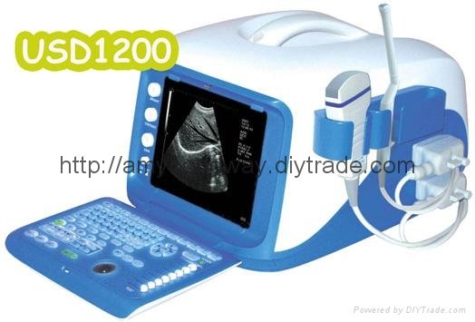 Digital Portable Ultrasound Scanner (BW8J)