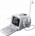 SS-8 Ultrasound B Scanner(PC Based)