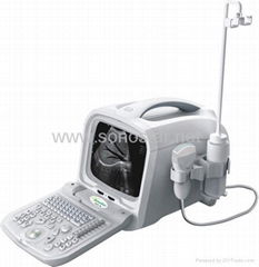  SS-8 Ultrasound B Scanner(PC Based) 