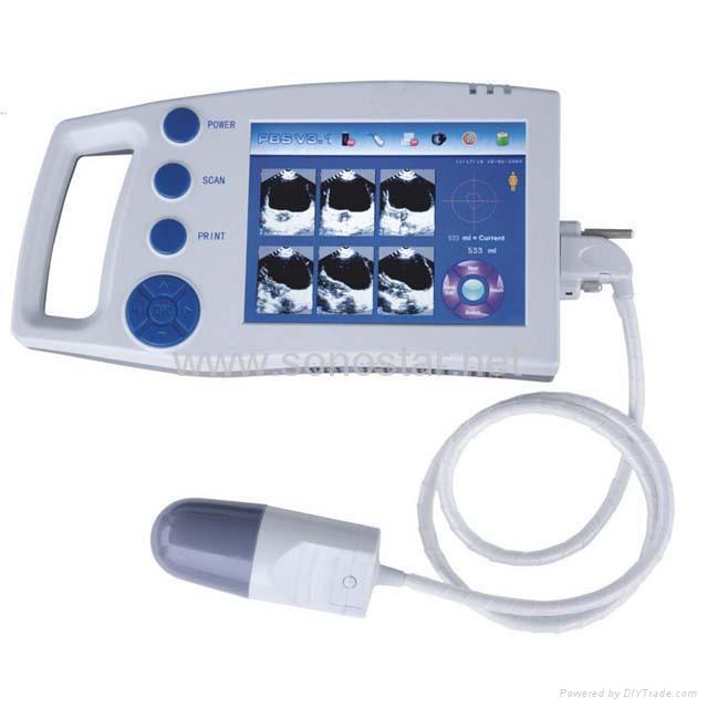 SB-1 Ultrasound Palm Bladder Scanner 