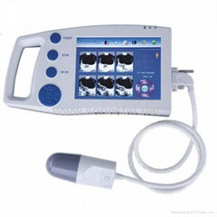 SB-1 Ultrasound Palm Bladder Scanner 