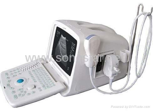 SS-6 Ultrasound B Scanner 