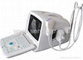 SS-6 Ultrasound B Scanner