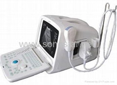 SS-6 Ultrasound B Scanner 