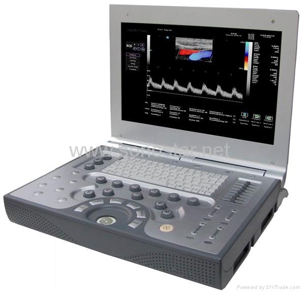 SS-1200 Color Doppler System (ultrasonic)