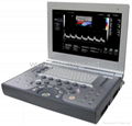 SS-1200 Color Doppler System