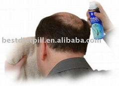 Herbal Hair Regrowth seller, Private Labeling, Best Price, Quality Guaranteed.