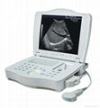 AR-3000E1 Laptop Full Digital Ultrasound Scanner