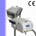 Nd yag laser for tattoo removal 2