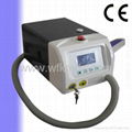 Nd yag laser for tattoo removal 3