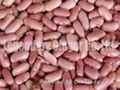 Light Red Kidney Beans 1