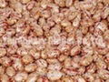 Light Speckled Kidney Beans( Round