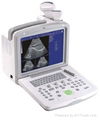 CE Approved B-Ultrasound Diagnostic Scanner CE  MK600B-3 1