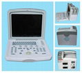 CE Approved B-Ultrasound Diagnostic Scanner CE  MK600B-3 2